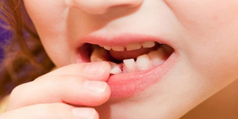 Tìm hiểu thông tin về giấc mơ thấy rụng răng không chảy máu