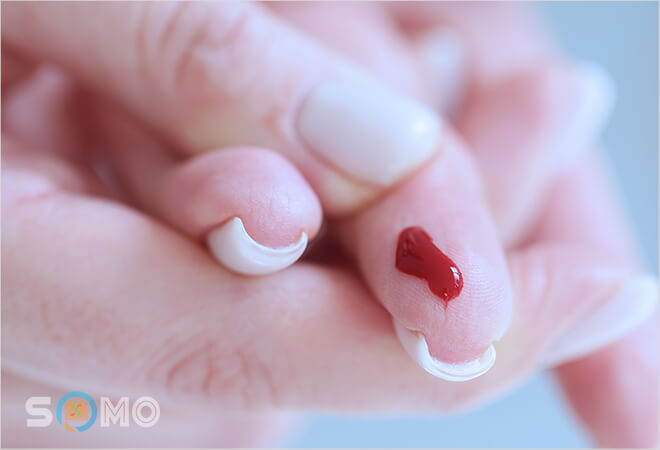 mơ thấy chảy máu đánh lô đề con gì